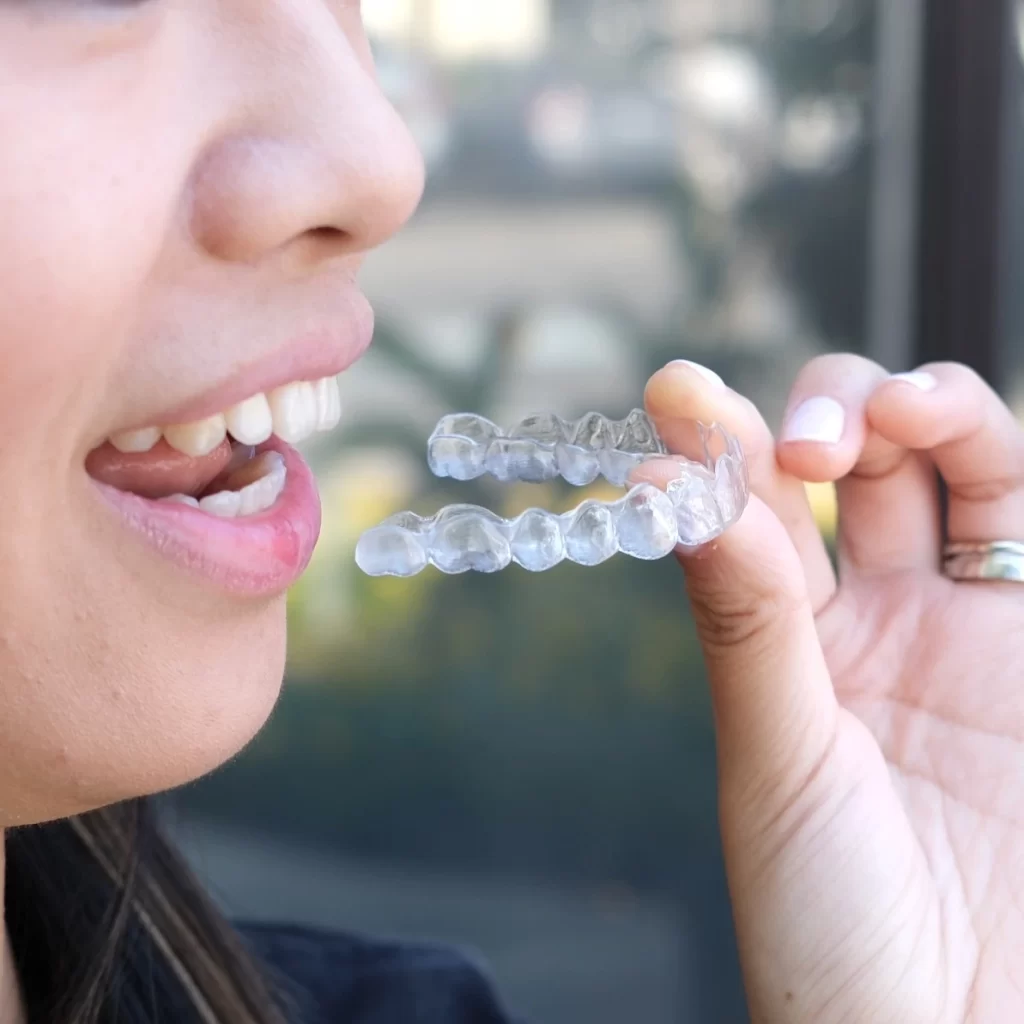 Invisalign teens clear aligner treatment in Cupertino, Fremont, and Milpitas at Agape Orthodontics