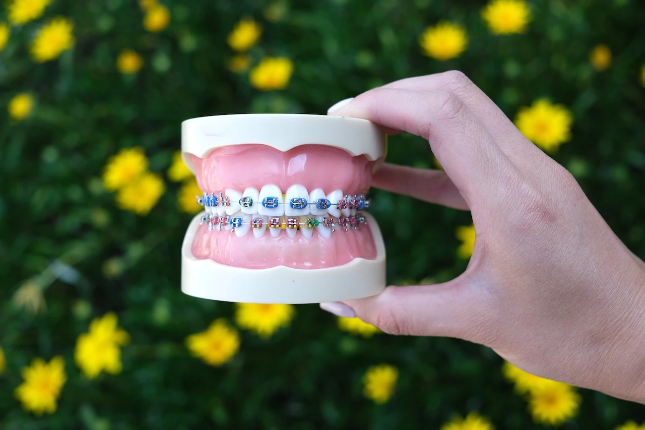 Braces vs. Invisalign: What’s the Best for Me?